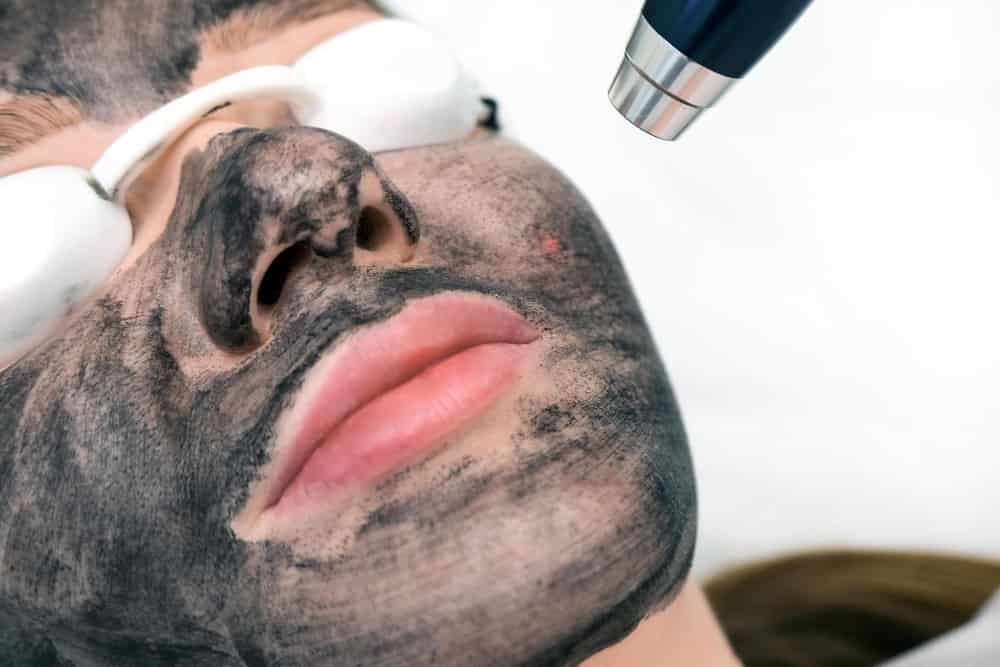 Laser carbon activo Sapphiraprive Benalmadena