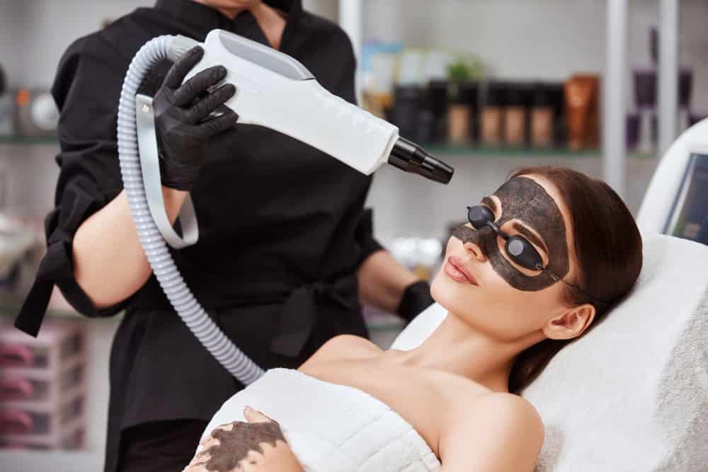 Tratamiento laser carbon activado
